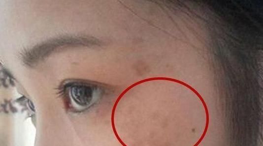 妇科疾病|女人患有妇科病,脸部会出现3个暗号,发现1个就最好去体检