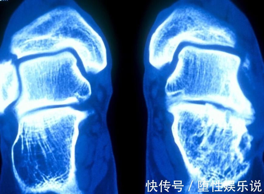 症状|提醒:孩子出现3个症状,说明长高“瓶颈期”到了,家长别忽视了