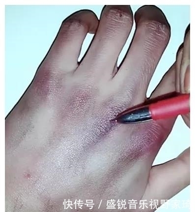 伤口|画“伤口”,开头觉得在瞎画,看到结局:老师必须准假