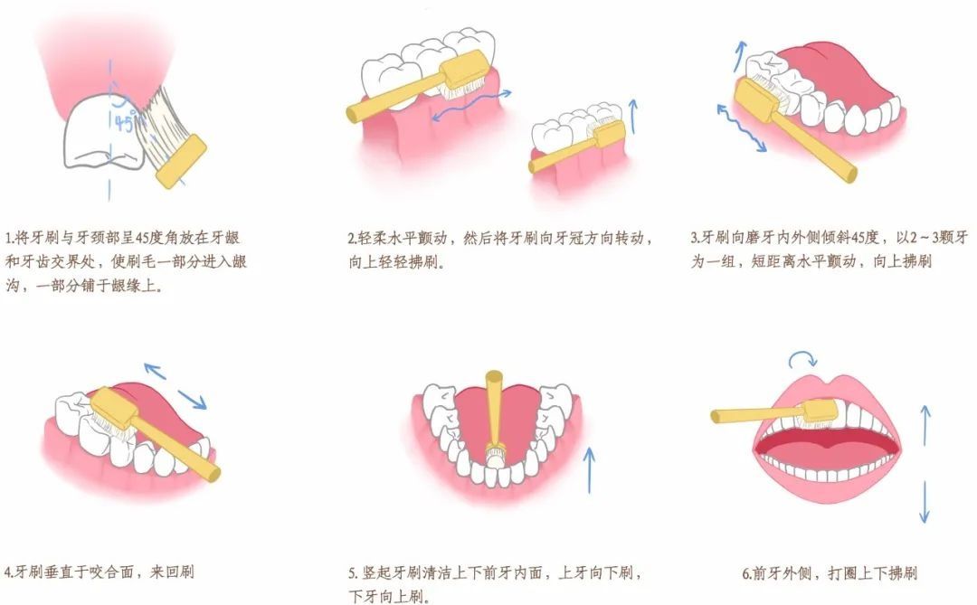 塞牙|【科普】一言不合就塞牙？背后藏着这些危害......