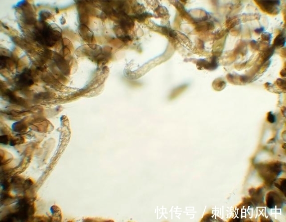 蚊子|夜里蚊子太烦人？78岁老中医教你用1中药，1分钟把蚊子消灭殆尽