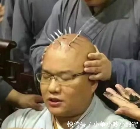戒疤|古代和尚为什么要烧几个戒疤?是为了区分还是因为虔诚?
