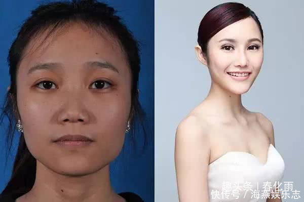 实拍：10张女孩整容前后的对比照，这真就是换了一张脸