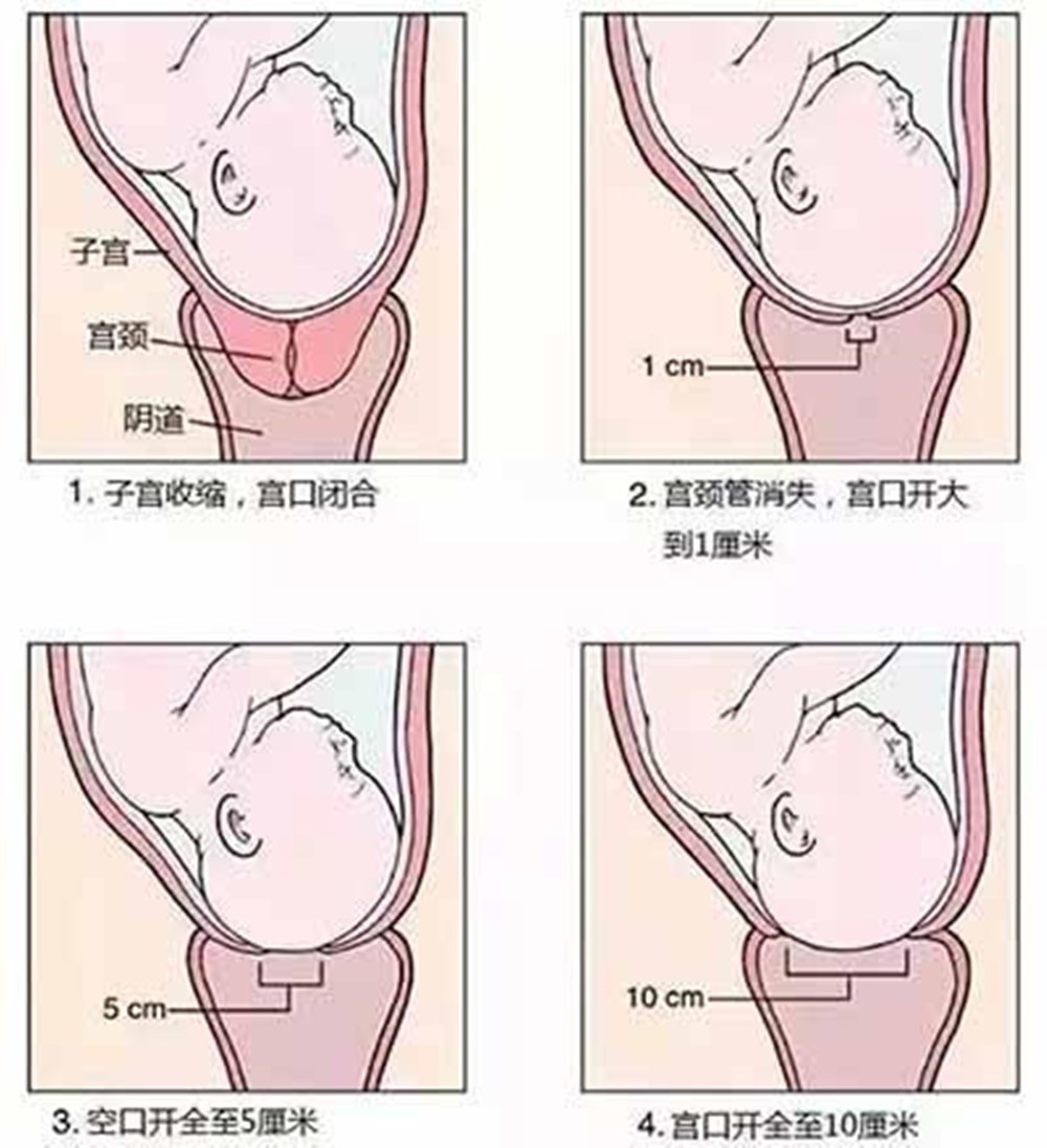 顺产|十个孕妇九个怕内检，这道“顺产关卡”有两大好处，孕妈要知晓
