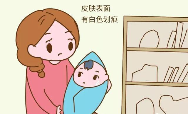 白开水|宝宝有这6个表现,说明正在缺水,很多妈妈却浑然不知