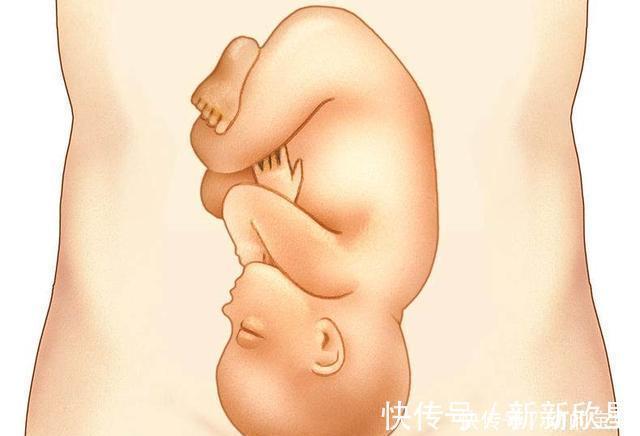 超重|胎儿是这个体重,你有福了,顺产时不受罪