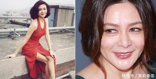 鼻梁|长期注射玻尿酸的人,皮肤会撑开变松弛?专业整形顾问告诉你