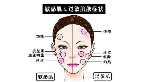 角质层|不会吧不会吧,好多人还不知道自己是敏感肌?怪不得皮肤越来越糟