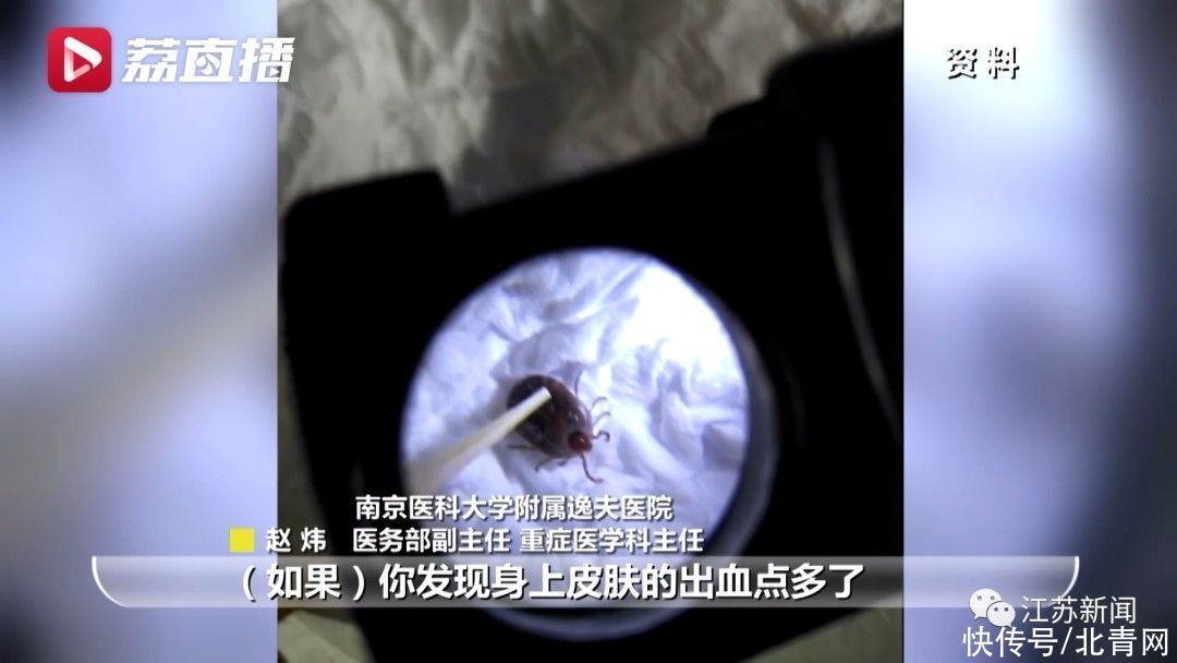 男子|男子钓鱼回家后发烧又咳血，一查竟感染可怕病毒！警惕