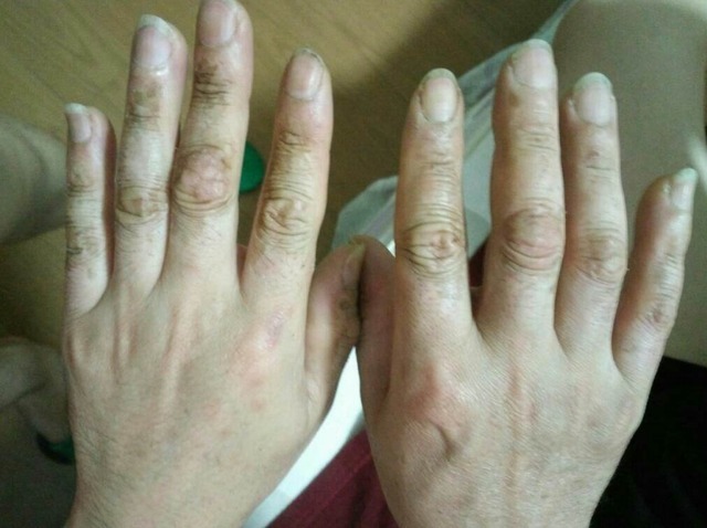 肠胃|消化科医生养胃很简单，3种“零食”，你若爱吃，胃自然好起来