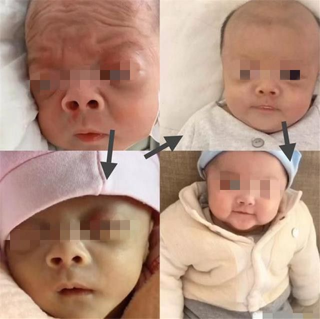 丑小鸭|还记得“丑哭妈妈”的网红宝宝吗?如今成功逆袭,丑小鸭变天鹅