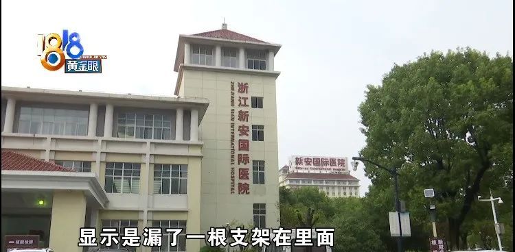 ct|术后小便一直出血，手术支架漏取一个