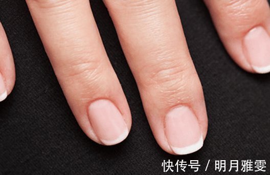 甲状腺功能|指甲上一个月牙都没有 别胡乱猜测了, 主要跟这几点有关!