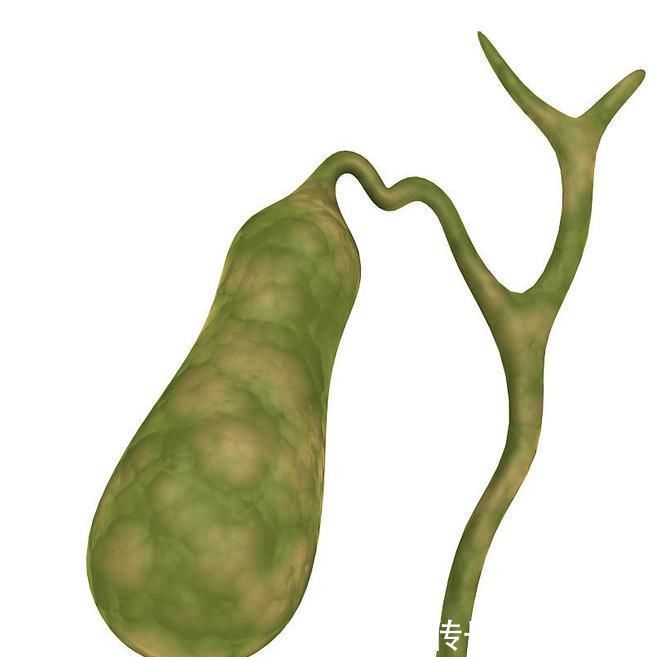 慢性胰腺炎|癌症一发现就是晚期，专家建议，身体的五种小病最好及时治疗