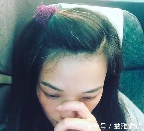 年轻人|为什么年轻人头发会早早变白?弄清楚这4方面,白发有希望变黑发