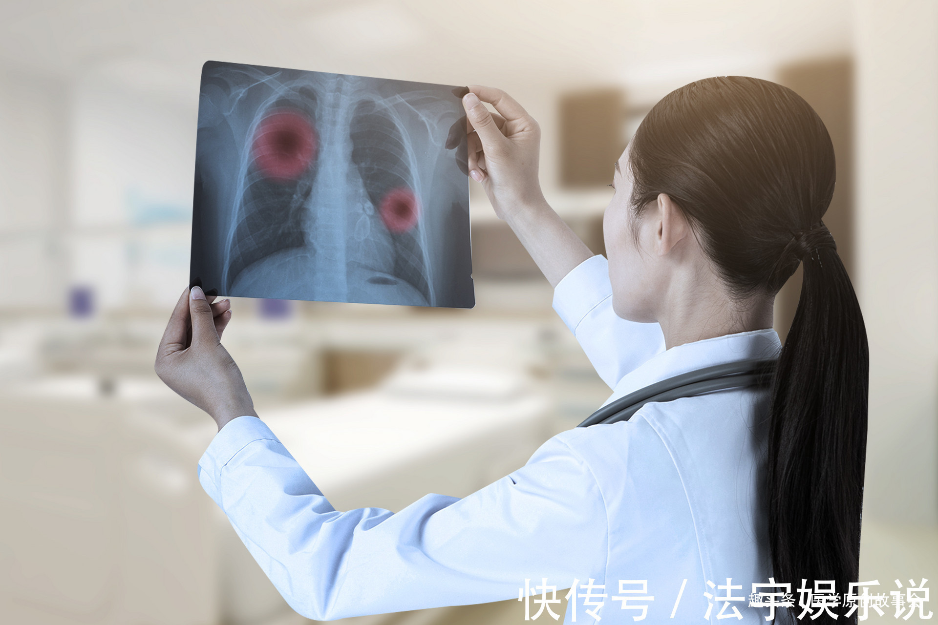 肿瘤科|肺癌根本不用治肿瘤科医生提醒,只要做好五点,可以长期生存