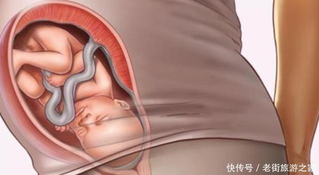 准妈妈|孕期做到“4不碰”,有利于保持羊水“清澈”,胎儿住着更干净