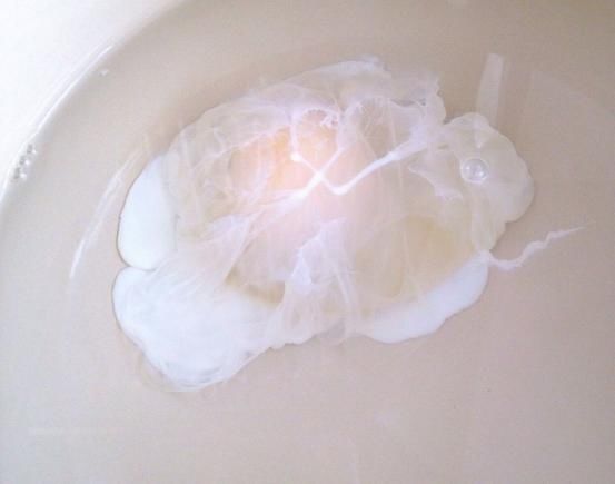  煮荷包蛋有诀窍，学会一次性煮10个，个个完整圆润、还不散花