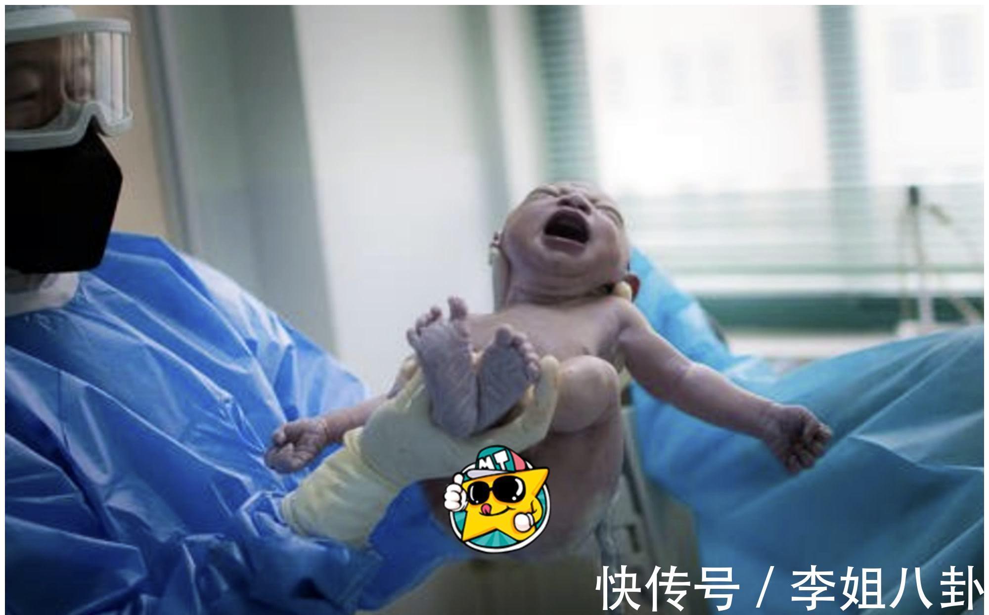 脚印|为何医院要给新生儿留脚印而不是手印？医生不明说，宝妈也要知道