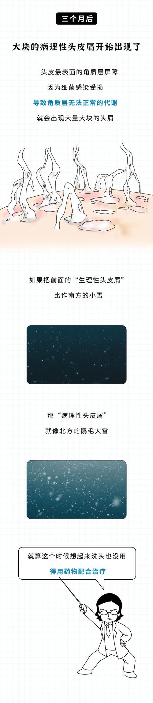 一个人如果一辈子不洗头会怎样？一组图告诉你，终生不洗头的结果