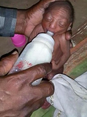 迪利|母亲生下宝宝,奇丑无比狠心抛弃,爷爷喂奶抚养长大创造奇迹