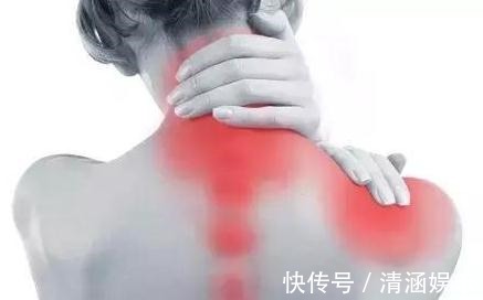 脑血管|一张古方流传1800多年,巧治颈椎病,至今还在发光发热!