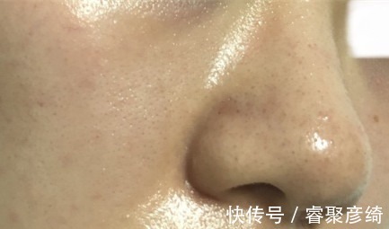 洗脸|为什么我的爽肤水不好用?