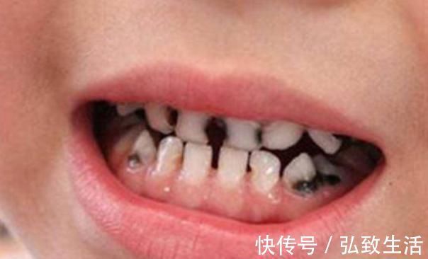 宝妈|想要宝宝牙齿洁白,这3点家长要做好,帮娃告别“小黑牙”