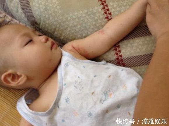 又到了宝宝的“手足口”高发期,别再让你的宝宝“受罪”了!