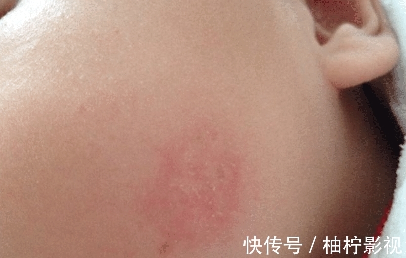 怀孕期间|宝宝生下来肤质不好,可能是因为这,孕妇应该注意了!