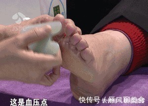 血压|长期高血压,这个地方就长茧!每天刮5分钟,血压奇迹般降下来!