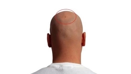 小利小惠|身上有这些痣的人,财旺福多,好运连连,享福不断