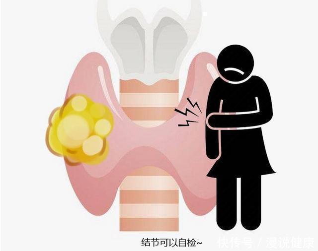 恶性|体检发现结节,是否会引发癌变4个结节,出现这些表现要警惕