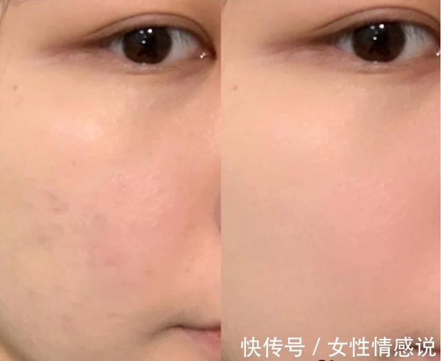 成分 孕期千万别乱用护肤品,公认6款“最靠谱”的护肤品,孕妇都在囤!