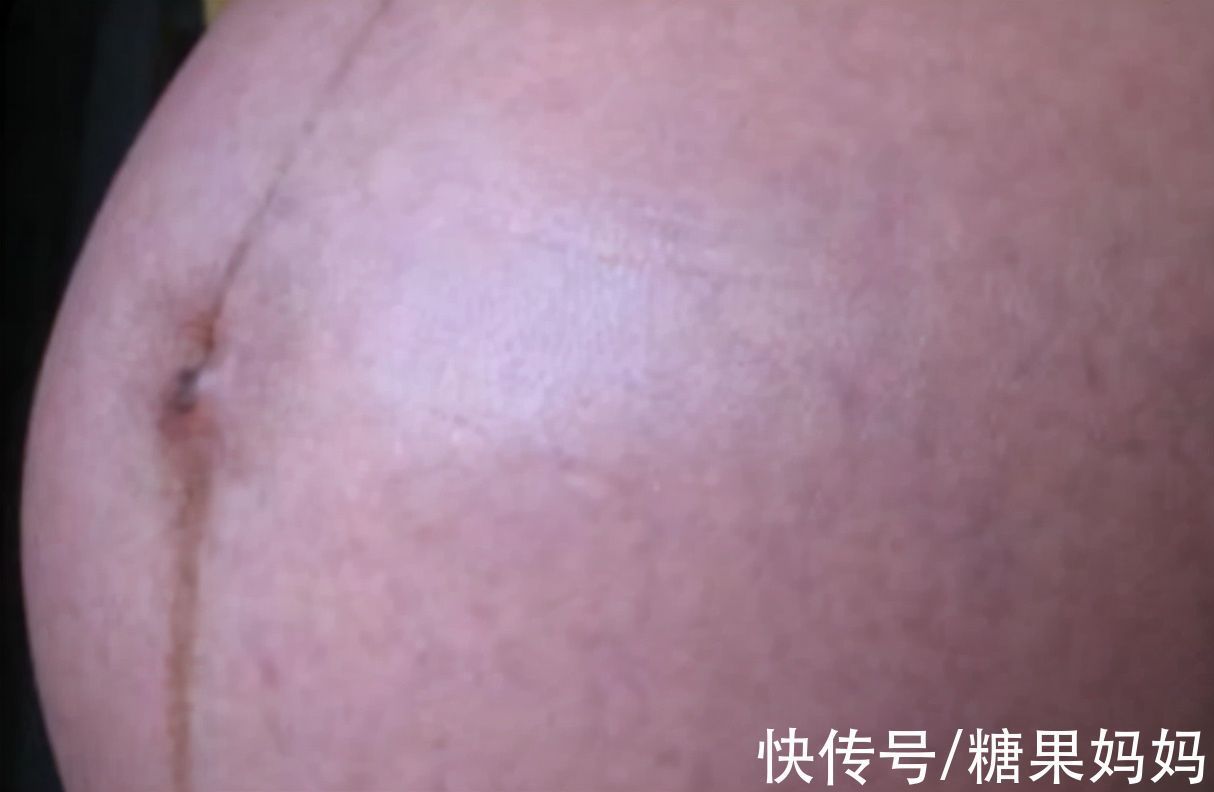 白线|准妈妈孕肚上的“神秘”黑线,能预知胎宝性别?那可不一定