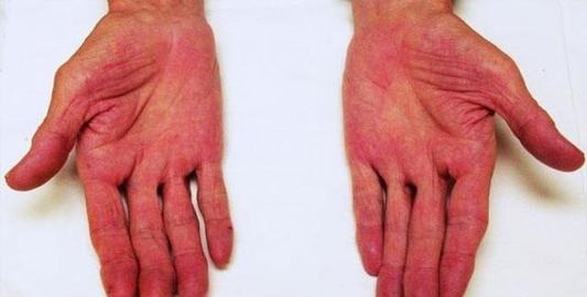 肝脏|肝好不好,看这4个部位,少吃3种食物,做好2件事,肝会越来越好