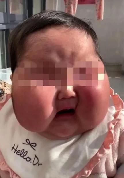 惩治|中国各地出现大头娃，是什么原因造成的，应该如何惩治？