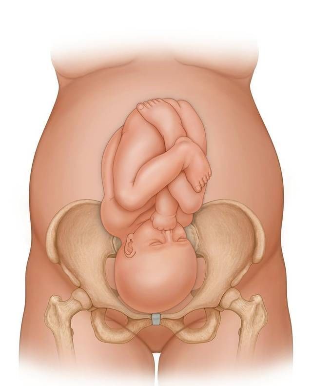 恢复|剖腹产不可避免产后松弛,但有方法可助恢复,而且安全成本还低
