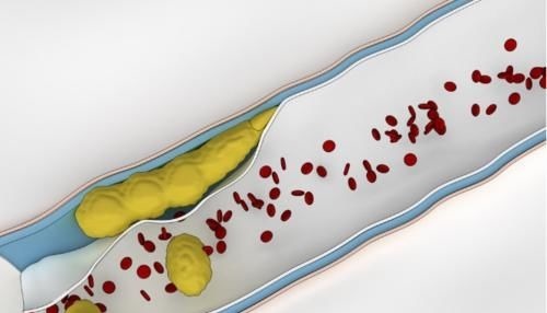 何首乌|一味中药坚持服用20天，就能把血脂降到正常