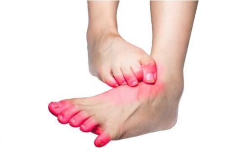 湿热|脚气痒、痒、痒!中医师:都是湿热惹的祸,简单一味药,帮你解决