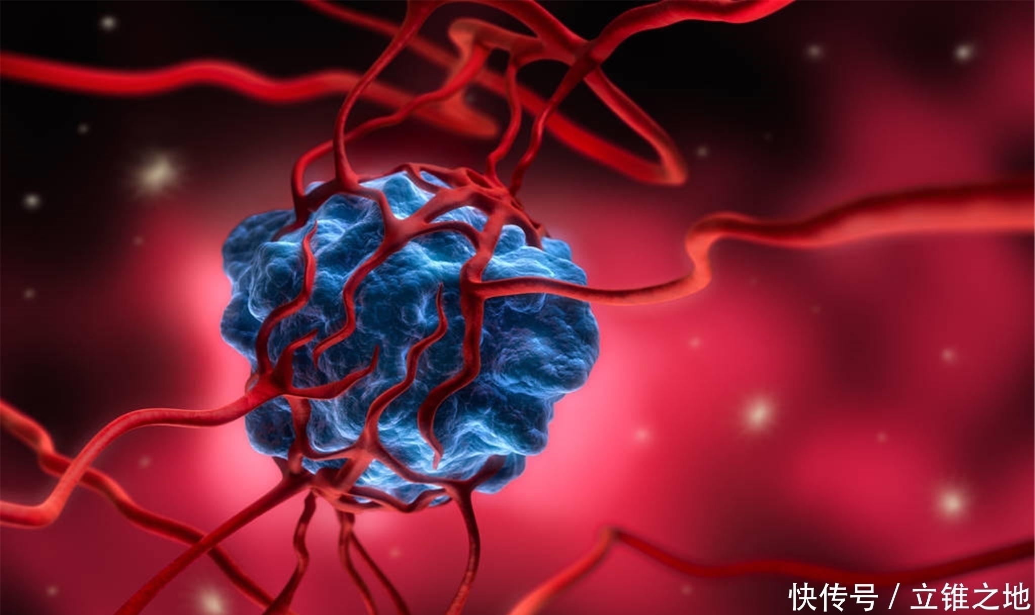 癌细胞|已经手术了,为什么肿瘤还会复发?分析了3种原因,得重视起来