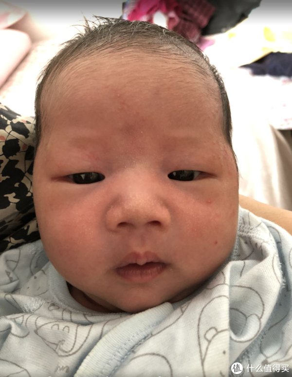 疹子|宝宝湿疹保湿霜哪家强？快来看看，避免入坑