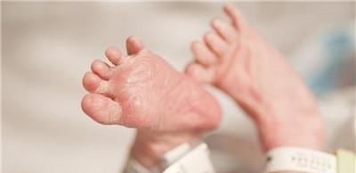 重症监护室|14年过去,原本身体巴掌大“世界最小宝宝”,如今颜值高到认不出