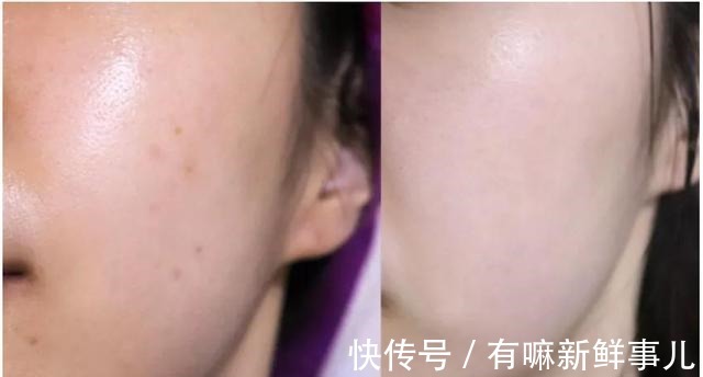 自我修护 如何提升皮肤的自我修护力避开这些护肤误区,皮肤才会越来越好!