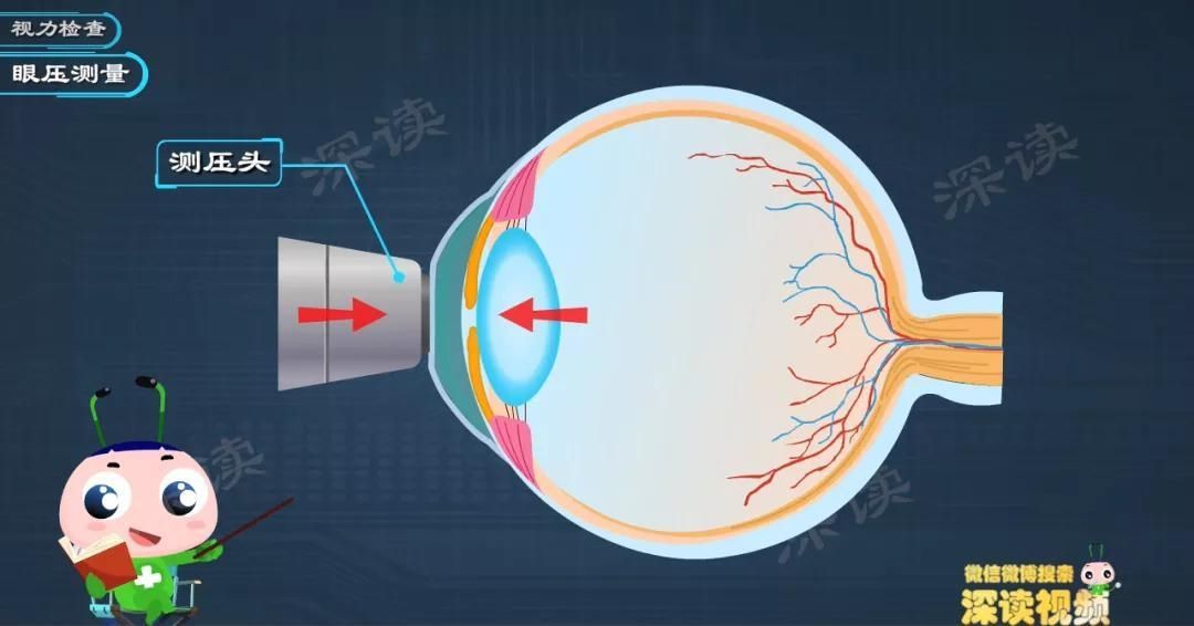 深读君|看眼底就能查青光眼？动漫科普青光眼检查黑科技