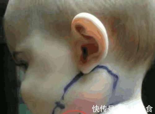 家里面|宝宝脖子长羽毛,家长当过敏治,医生说出原因家长吓出一身汗