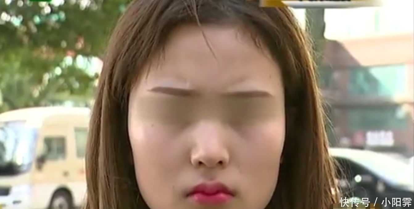 18岁姑娘为了美,割了耳朵垫鼻子,手术后结果还不如之前好看