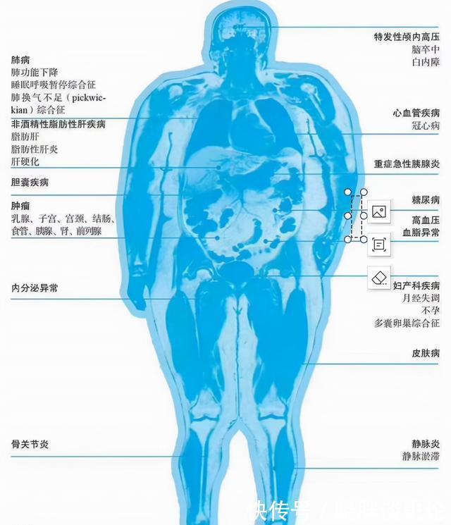妊娠期|孕期到底要增重多少才合理?快来对照一下你超标没