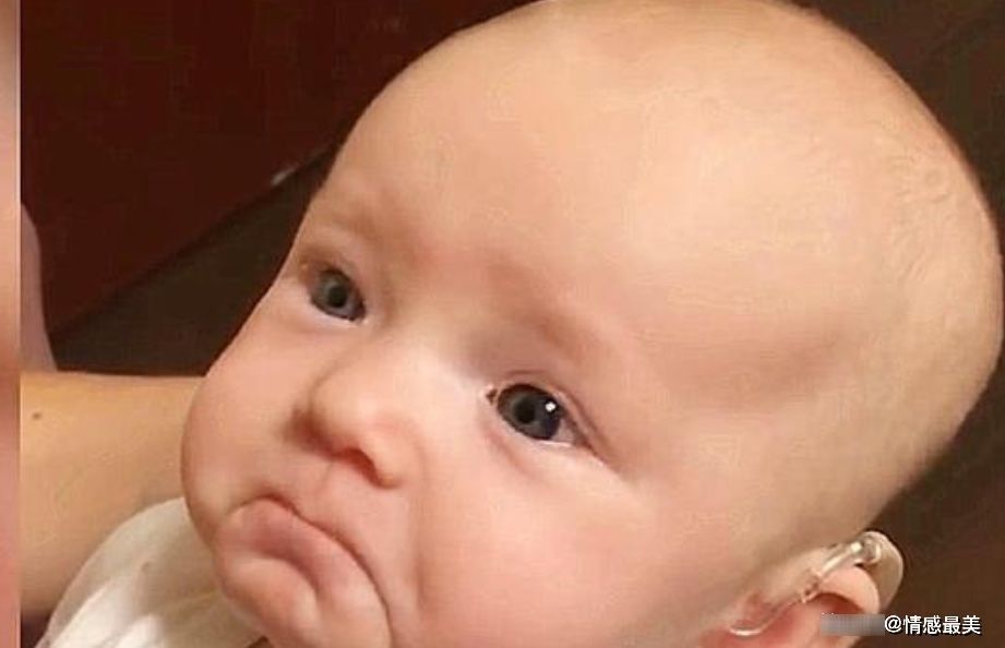 助听器|新生宝宝先天失聪,戴上助听器宝妈喊他,宝宝的表情家人泪目