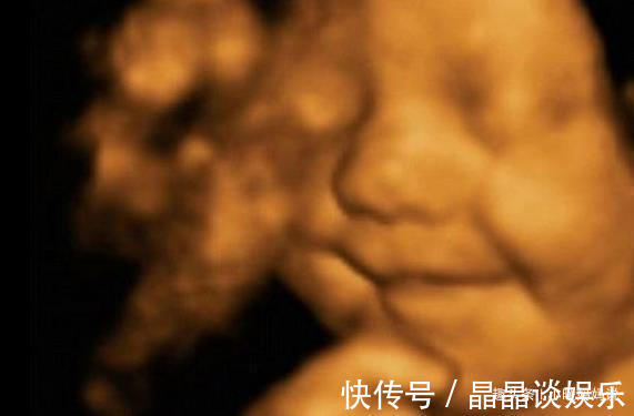 宝宝|9个月胎儿在肚子里的萌表情,你见过几个,医生现在孩子成精了